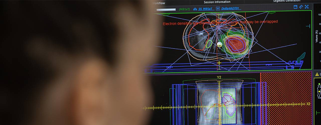Planificación dosis radioterapia. MR Linac. Clínica Universidad de Navarra