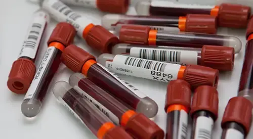 analisis-tubos-laboratorio-hematologia <p>Imagen de tubos de análisis de sangre del Laboratorio de Hematología de la Clínica Universidad de Navarra </p>