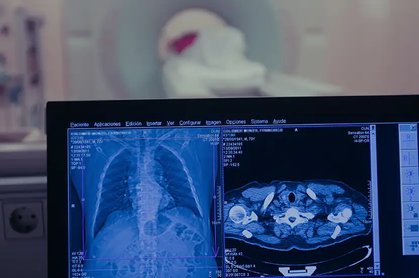 img-destacado-investigacion-radiologia